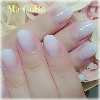 三木市ベースジェル一層残し のフォトギャラリー Tredina