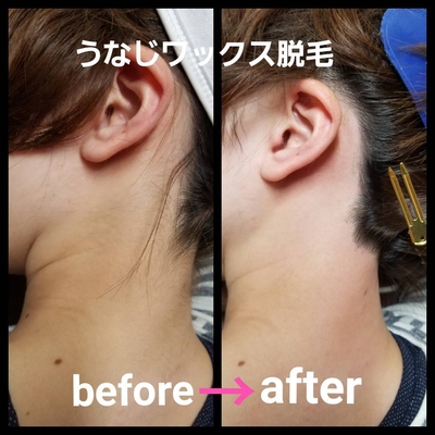 Salon De Ivyのスナップ お肌 ワックス脱毛 ブラジリアンワックス Tredina